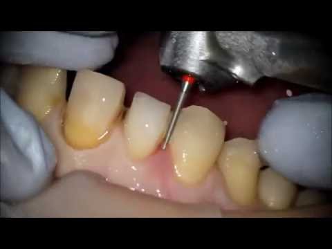 Ozel Yesilyurt Agiz Ve Dis Sagligi Poliklinigi Karabaglar Doktortakvimi Com