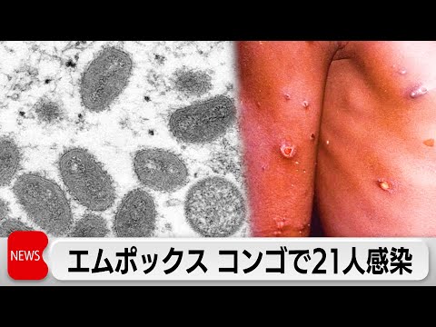 猿痘 - Medipedia