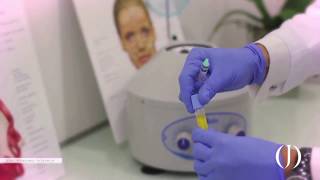 ¿Qué es el Plasma Rico en Plaquetas o PRP I Medicina Estética Barcelona Dr. Junco