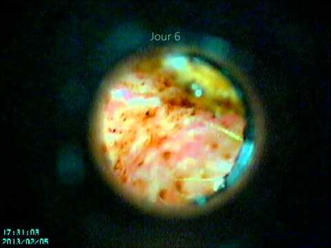 comment soigner tique chat