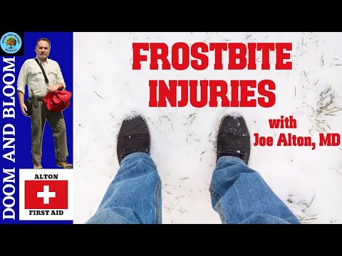 FROSTBITE INJURIES with DR. ALTON