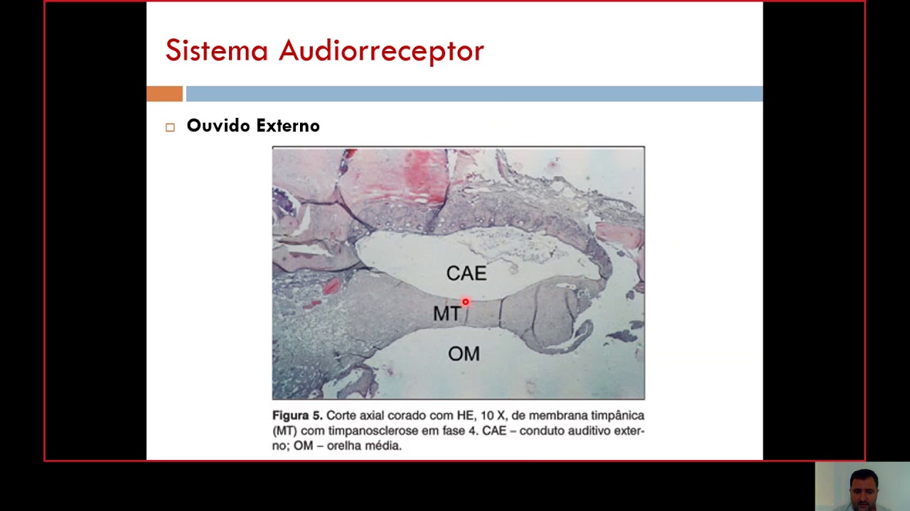 (Semestre 3C) Aula 03 - Sistema Audiorreceptor