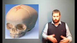 The human skeleton