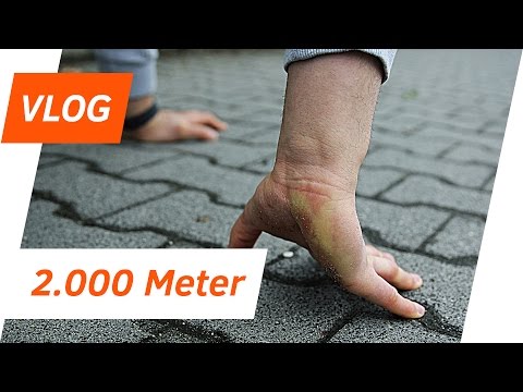 Welche Salben vom Ekzem Das Birkenpech gegen atopitscheskogo der Hautentzündung