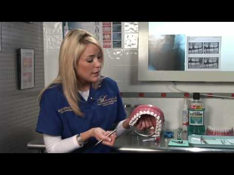 YouTube video about: What happens during a teeth cleaning?