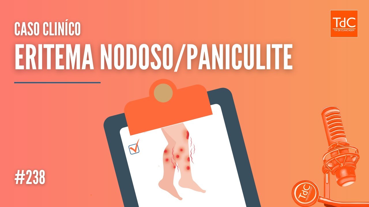 Episódio 238 - Eritema Nodoso/Paniculite CASO CLÍNICO
