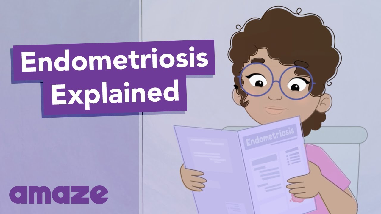 Endometriosis Explained