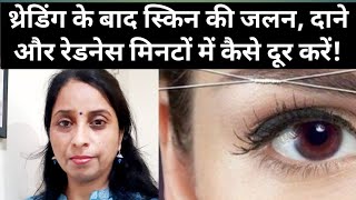 How To Remove Skin Irritation, Rash, Redness After Threading? || @poojaluthra