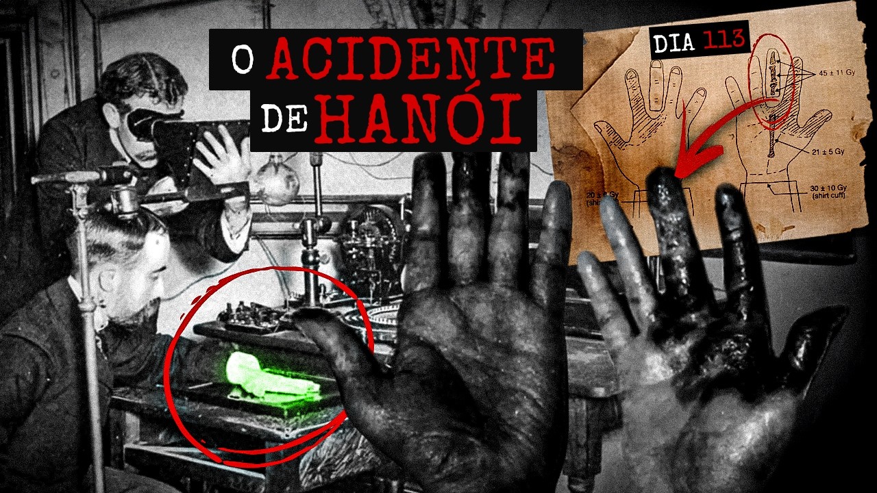 Ele Colocou a Mão Em Um Acelerador De Partículas Ligado - O Acidente de Hanoi