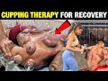 Cupping Therapy - Gym Jate Ho Toh Ye Therapy Zarur Karana | Ep.03