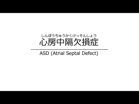 心房中隔欠損症