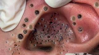 𝑺𝒐𝒐𝒕𝒉𝒊𝒏𝒈 𝑭𝒂𝒄𝒊𝒂𝒍 𝑻𝒓𝒆𝒂𝒕𝒎𝒆𝒏𝒕 𝑭𝒐𝒓 𝑺𝒕𝒓𝒆𝒔𝒔 𝑹𝒆𝒍𝒊𝒆𝒇 𝒂𝒕 𝑳𝒖𝒙𝒖𝒓𝒚 𝑺𝒑𝒂 𝑨𝒄𝒉𝒊𝒆𝒗𝒆 𝑰𝒏𝒏𝒆𝒓 𝑷𝒆𝒂𝒄𝒆 #887987