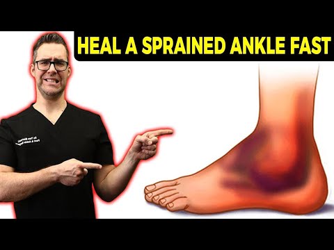 High Ankle Sprain & Syndesmotic Ankle Sprain [Test & Recovery Time]