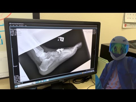 YouTube video