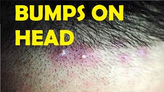 how to get rid of bumps on head after haircut
