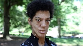 Same But Different Part 2 - My New Face