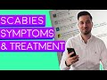 Scabies | Scabies Treatment | Scabies Symptoms
