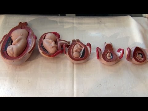 Stiri crestine - Mapamond Crestin 610 - 27 martie 2016 - o editie speciala Pro-Viata