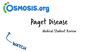 Paget Disease: Osmosis