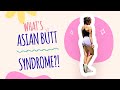 What S ASIAN BUTT SYNDROME