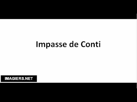 How to pronounce Impasse de Conti