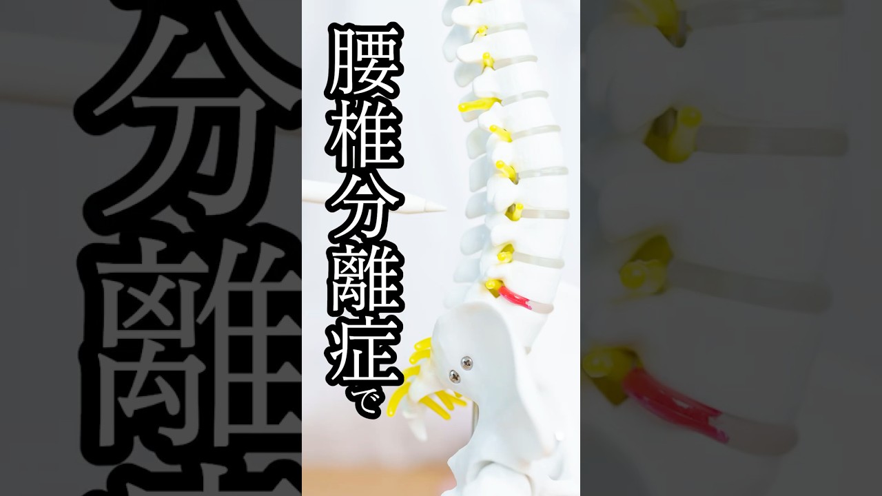 分離症にはハイブリット thumbnail