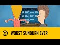 Worst Sunburn Ever Beavis And Butt Head Comedy Central Africa