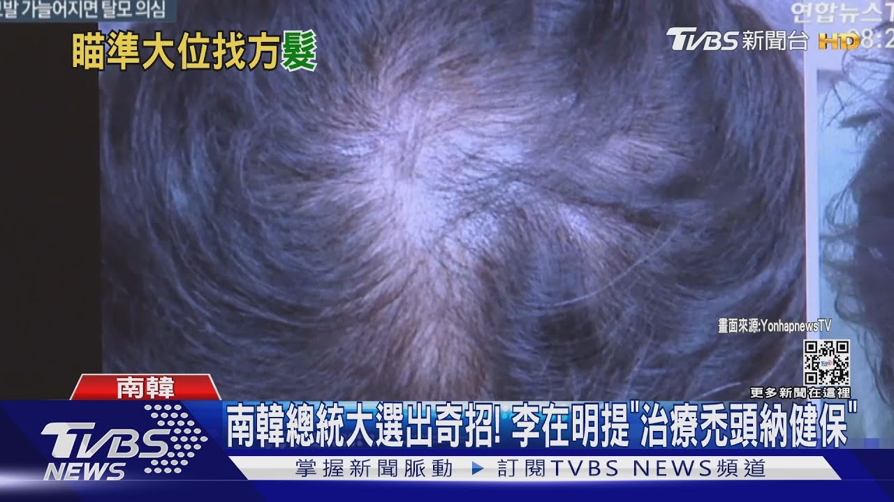 南韓總統大選出奇招! 李在明提「治療禿頭納健保」