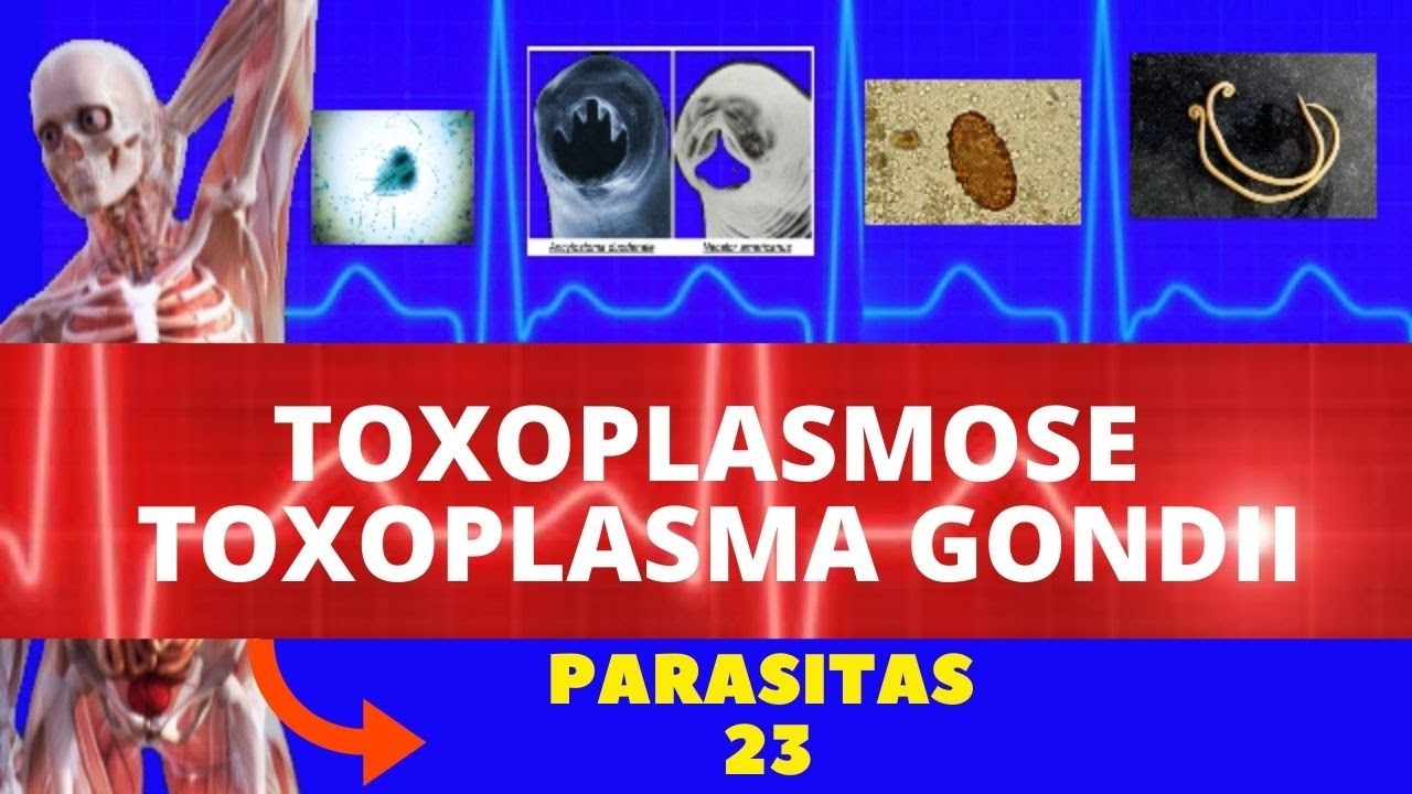 TOXOPLASMOSE -TOXOPLASMA GONDII - PARASITOLOGIA | INFECTOLOGIA