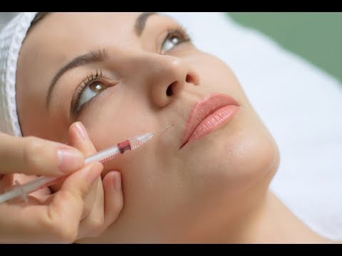 Tratamiento efecto lifting con hidroxiapatita cálcica