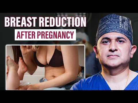 Breast Reduction Surgery | Breast Reduction After Pregnancy | When is the Right Time? | Dr. Parag