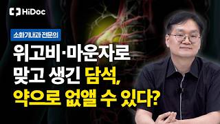 위고비·마운자로 맞고 몸에 돌이 생겼다? 담석증 원인부터 치료까지