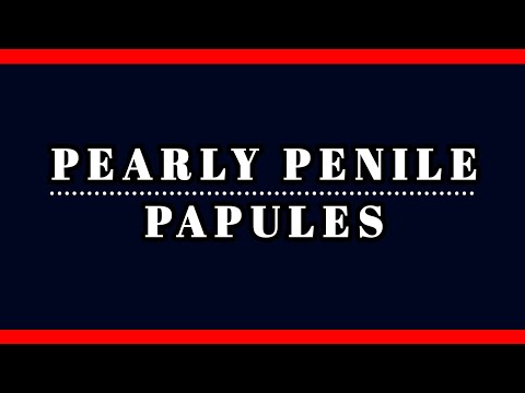 Pearly Penile Papules : Causes, Symptoms, and Treatment Explained