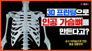 흉부외과용 수술기구