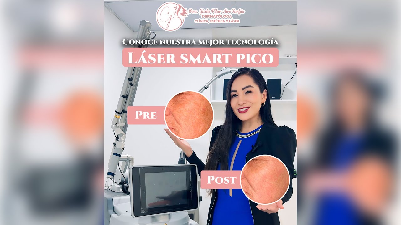 ✨ ¡𝗖𝗼𝗻𝗼𝗰𝗲 𝗻𝘂𝗲𝘀𝘁𝗿𝗮 𝗺𝗲𝗷𝗼𝗿 𝘁𝗲𝗰𝗻𝗼𝗹𝗼𝗴𝗶́𝗮: 𝗟𝗔́𝗦𝗘𝗥 𝗦𝗠𝗔𝗥𝗧 𝗣𝗜𝗖𝗢! ✨ - Dra. Gisela Pilar Aire Farfán