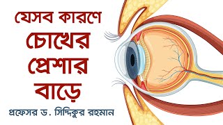 গ্লকোমা রোগের কারণসমূহ | CAUSES OF GLAUCOMA | Dr. Siddiqur Rahman | Glaucoma & Refractive Surgeon