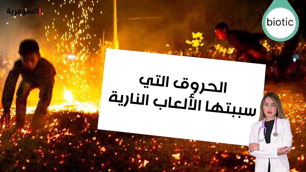 فيديو | الحروق التي سببتها الألعاب النارية