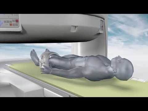 Il punto di proiezione delle articolazioni dellanca Diagnosi raggio di lesioni delle articolazioni