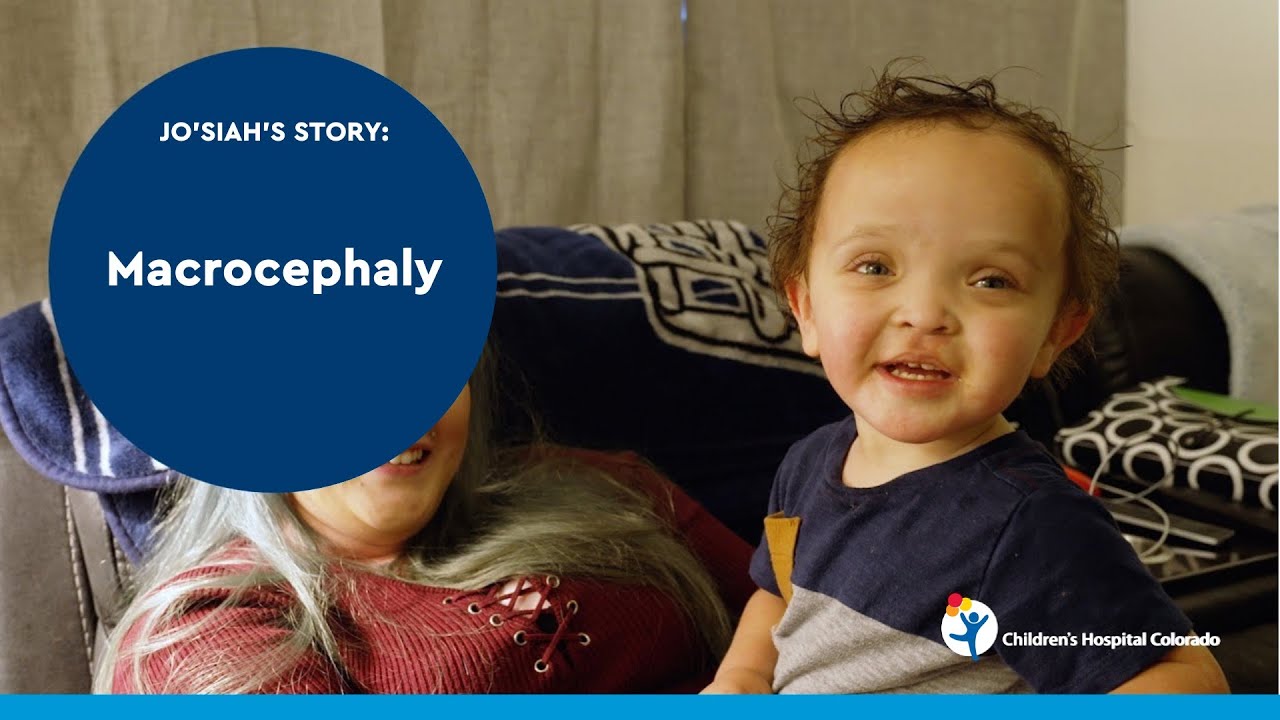 Jo’siah’s Journey with Macrocephaly at the Vascular Anomalies Center