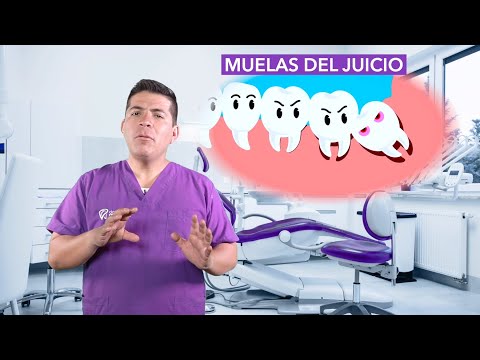 🧐 ¿Qué son las muelas del juicio?