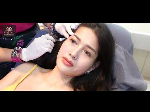 ฉีดฟิลเลอร์ (Filler) ใต้ตา ขมับ / Chartier Clinic ชาเทียร์ คลินิก