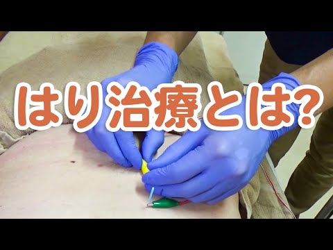 はり治療とは?