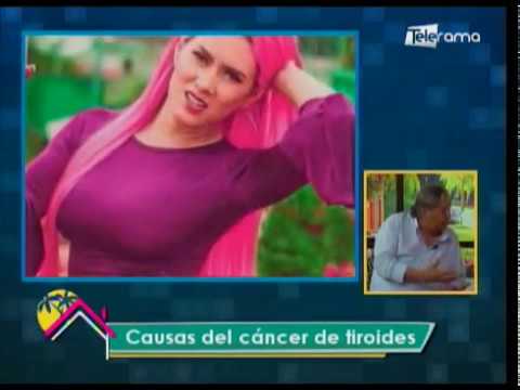 Causas del cáncer de tiroides 