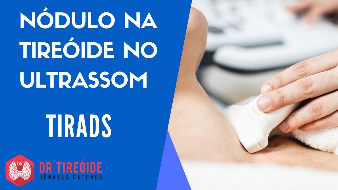 Classificação de TIRADS dos nódulos da tireóide no Ultrassom - Dr Tireóide responde #79#