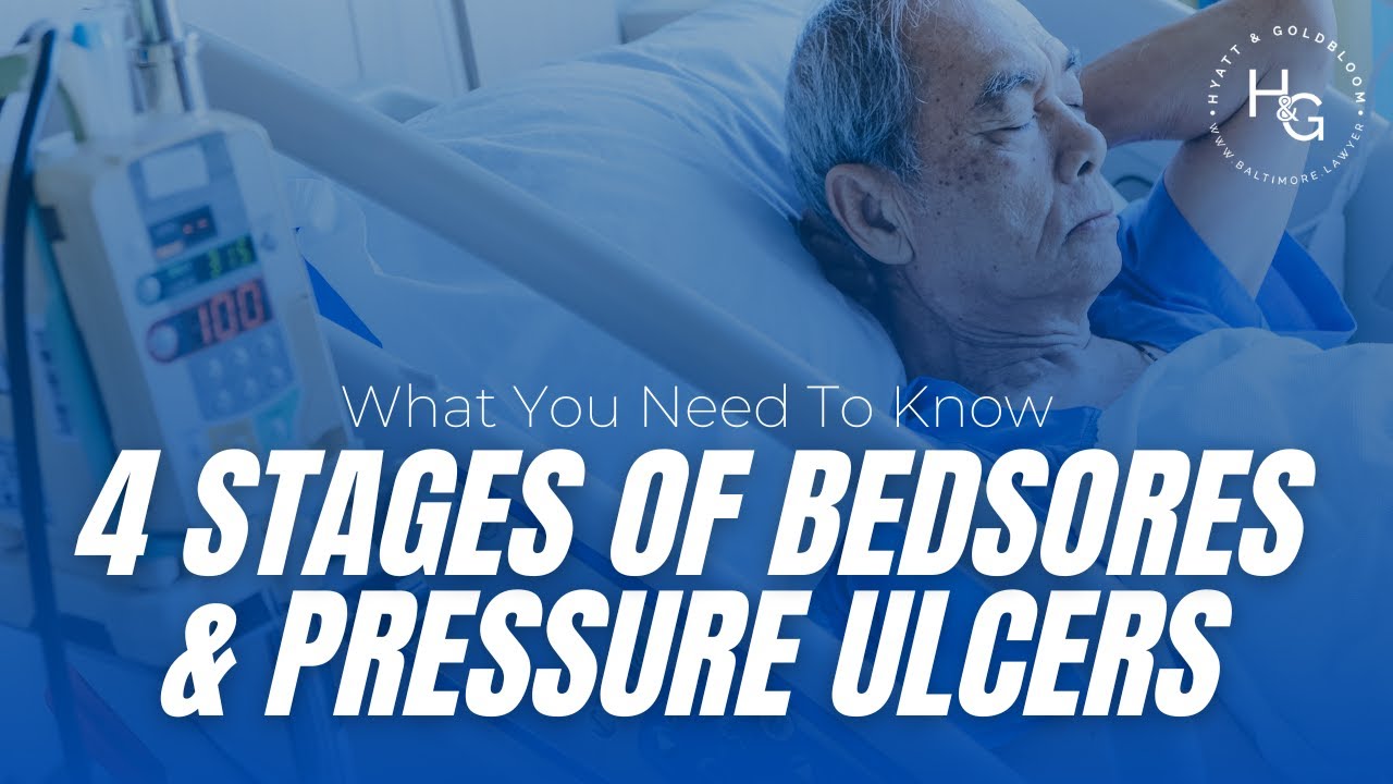 The 4 Stages Of Bedsores & Pressure Ulcers