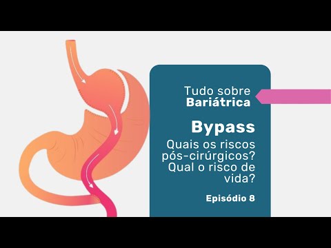 Bypass Gástrico: o que é, como funciona e o que muda na sua digestão 5 Diferença entre bypass e sleeve: qual a melhor? — Dr. Rodrigo Barbosa