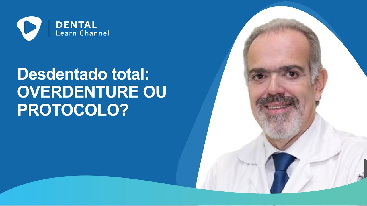 Desdentado total: overdenture ou protocolo?