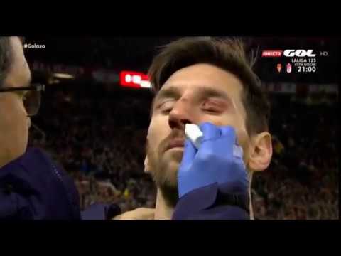 MESSI NO TIENE LA BAJA MÉDICA, NO HAY FISURA