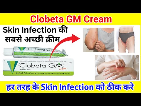 20g Clobetasol Propionate Neomycin Sulphate Miconazole Nitrate Cream