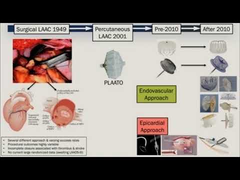 Jacqueline Saw, MD, FRCPC, FACC, FAHA, FSCAI - LAA Closure for AFib Patients
